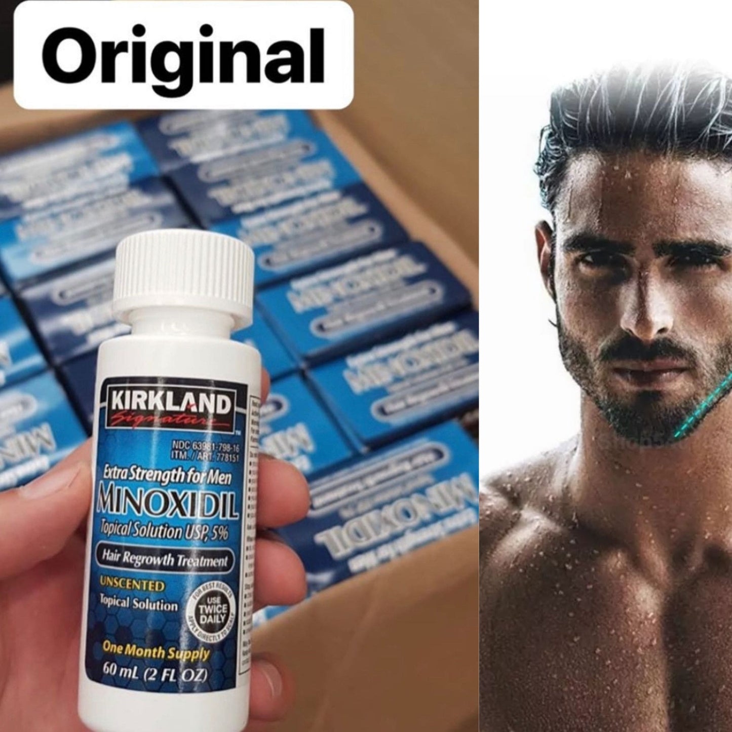 Minoxidil Kirkland 5% –  | Original